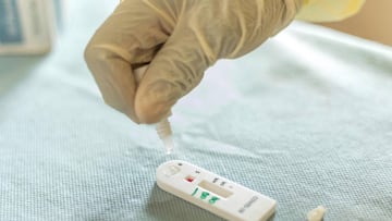 A blood sample for COVID-10 coronavirus testing is processed at the CadjxE8houn Health Center in Cotonou on May 9, 2020. - Benin on Saturday was conducting mass coronavirus testing of teachers ahead of the reopening of schools as part of a plan to loosen 