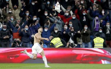 Asensio ense?a los dientes