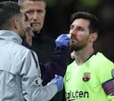 Messi sólo tiene un fuerte hematoma en la nariz y estará disponible ante el United