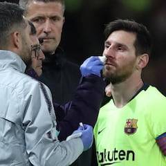 Messi sólo tiene un fuerte hematoma en la nariz y estará disponible ante el United