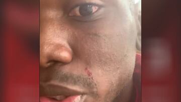 Pogba muestra los riesgos de entrenar con "el hombre de hielo"