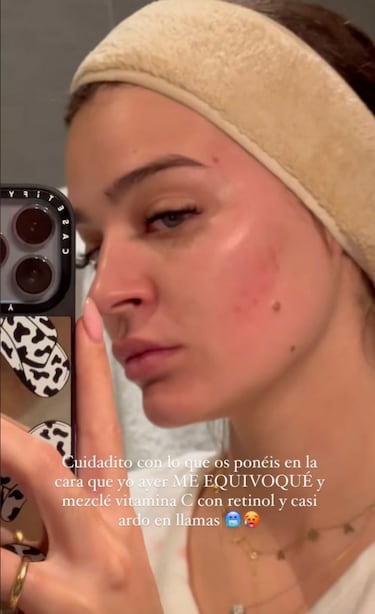 El error garrafal de Laura Escanes: “Casi ardo en llamas”