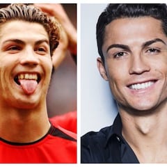 Deportistas y famosos a los que el dentista les cambió la vida