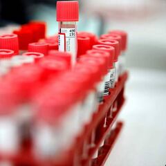 Coronavirus: Wuhan scientist hits out at China conspiracy theories