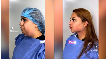 La operación estética de una mujer que ha dejado boquiabierto a todos con más de 6M de visitas