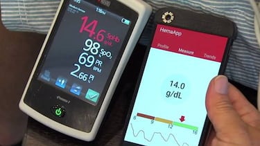 Detecta la anemia con la cámara de tu móvil