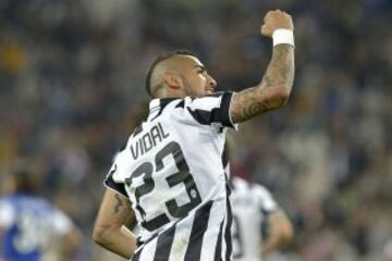 Arturo Vidal realiza la pretemporada con Juventus, pero regresa lesionado de la Selección después de los partidos con México y Haití. Vuelve a jugar el 24 de septiembre, anota y critíca a quienes dudan de su recuperación.