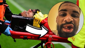 Así ha quedado la mandíbula de Loftus-Cheek tras su escalofriante choque