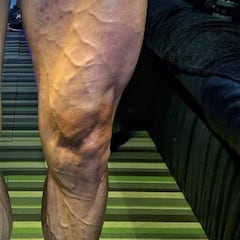 La impactante imagen de las piernas de Rojas en el Giro