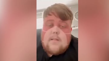 La broma que revienta TikTok: ¡fingió haberse dormido al sol con una mascarilla!