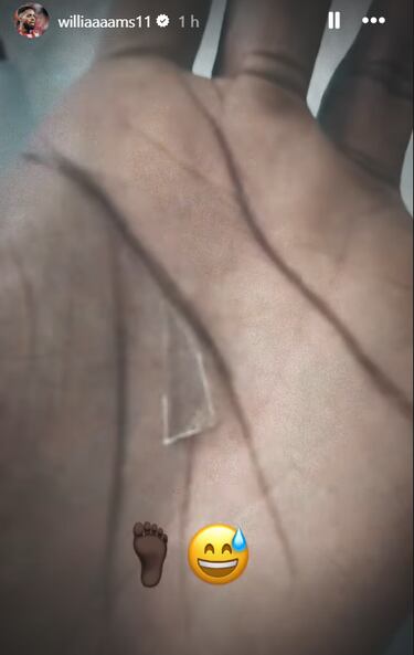 I?aki Williams ha jugado dos a?os con un cristal de 2 cent¨ªmetros en la planta de un pie