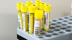 LA AMA exculpa el dopaje por jugar en un campo con césped artificial