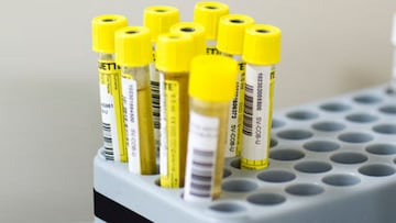 LA AMA exculpa el dopaje por jugar en un campo con césped artificial