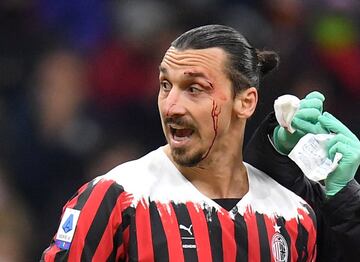 El chileno Gary Medel y el sueco Zlatan Ibrahimovic protagonizaron un fuerte choque durante el partido entre el AC Milan y el Bolonia. Los dos jugadores quedaron tendidos en el césped, sangrando. Necesitaron de asistencia médica para poder incorporarse.
