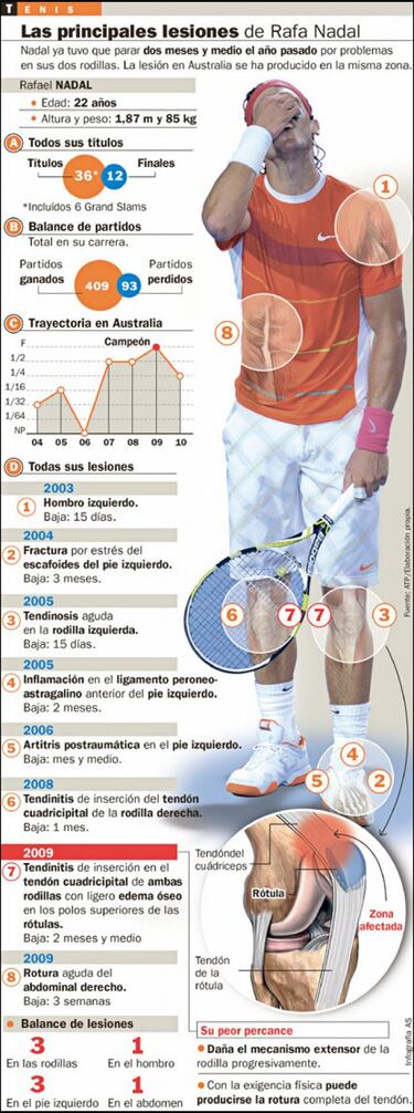 Preocupa la rodilla de Nadal
