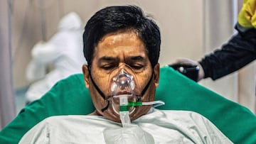 Juan Carlos Lara, 59, a patient with COVID-19, remains on a stretcher at the Intensive Care Unit of the Rebagliati Hospital, in Lima, after being transferred from Iquitos in an air ambulance, on September 01, 2020. - A small air ambulance is helping save patients in a severe condition due to the new coronavirus in remote zones of Peru, one of the countries most affected by the pandemic, which has a winding geography and a deficient highway system. (Photo by Ernesto BENAVIDES / AFP)