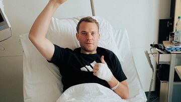 Manuel Neuer levantando el pulgar en se&ntilde;al de que est&aacute; bien tras ser operado de la pierna por haber ca&iacute;do mientras esquiaba, despu&eacute;s del Mundial de Qatar 2022. 