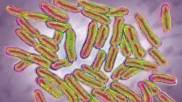 Aunado a la pandemia de coronavirus, Estados Unidos enfrenta un nuevo brote de salmonella en más de la mitad de los estados. Aquí cuáles están afectados.