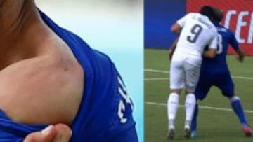 Luis Suárez, mordiendo. Y la imagen de Chiellini.