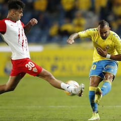 La mutación de Jesé