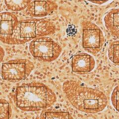 Crean la primera vacuna contra el virus de la esclerosis múltiple y la mononucleosis