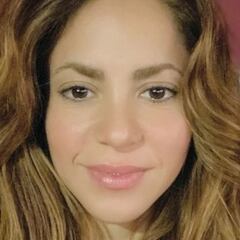 Shakira se enfrenta a unos jabalíes: "Me han reventado todo"
