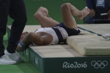 El gimnasta francés se fracturó la tibia de su pierna izquierda tras un mal salto. Sus compañeros no lo pedían creer. La peor imagen de Río 2016.