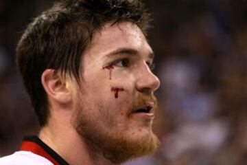 Andrew Shaw de los Chicago Blackhawks.