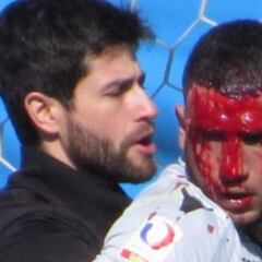 El impactante corte que sufrió Viana ante Coquimbo Unido