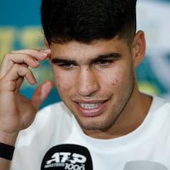 Alcaraz: “Si digo que estoy al 100%, mentiría”