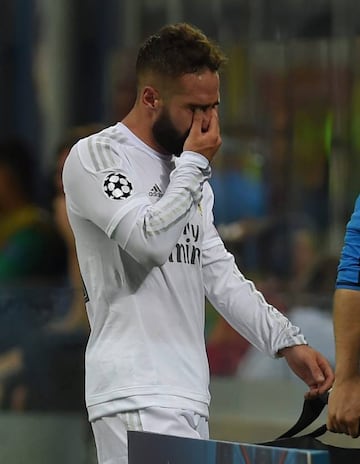 Carvajal in tears as has to leave the Champions League final.