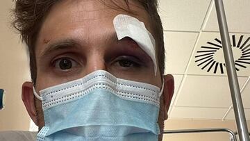 El ciclista del Cofidis Rubén Fernández muestra su herida en la ceja tras el atropello que sufrió mientras entrenaba.