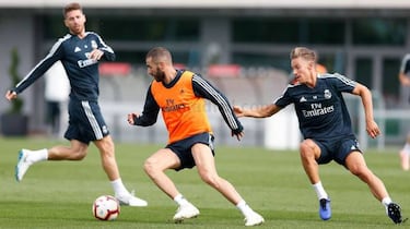 La extraña lesión de Benzema