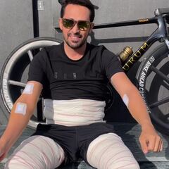 El impactante estado de Contador tras pasar por quirófano