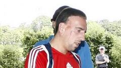 El Madrid, preocupado por las lesiones de Ribéry