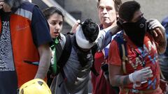 Joven perdió sus ojos tras recibir disparos de balines por parte de la policía