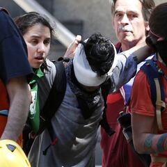 Joven perdió sus ojos tras recibir disparos de balines por parte de la policía