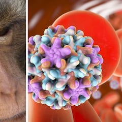 ¿Qué es el virus B y cuáles son sus síntomas?: detectan primer caso humano en Hong Kong, tras ataque de mono