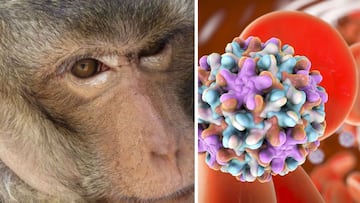 ¿Qué es el virus B y cuáles son sus síntomas?: detectan primer caso humano en Hong Kong, tras ataque de mono