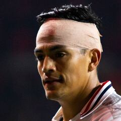 Chapo Sánchez, al quirófano por golpe en el ojo