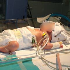 Un bebé prematuro de 580 gramos nacido en Perú consigue vencer al coronavirus