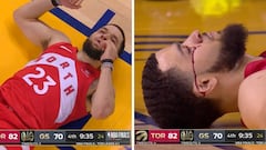 Un diente roto y sangrando: la acción más desagradable de las Finales