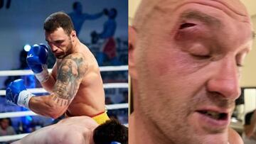 El sueco Agron Smakici, que cort¨® a Tyson Fury en el sparring.