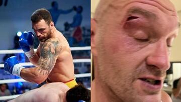 El sueco Agron Smakici, que cortó a Tyson Fury en el sparring.