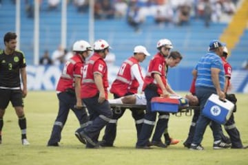 El mediocampista hondureño sufrió una impactante lesión, luego de que Javier Aquino le cayó encima de la pierna en una jugada sin intención en el duelo de Concacaf.