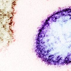 El brote del virus nipah en la India no es de ahora, es de 2018