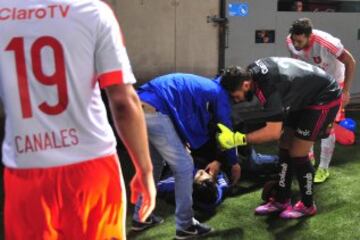 Hinchas de Universidad de Chile sufren un accidente durante el partido contra Audax Italiano por primera division en el Bicentenario de La Florida en septiembre pasado.  