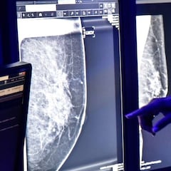 ¿Por qué el plan de salud de AMLO es inviable y qué otras alternativas hay?