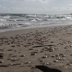 ¿Qué se debe hacer si te pica una medusa y cómo hay que tratar la picadura?
