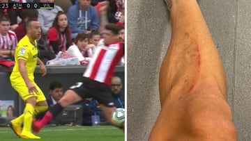 Así quedó la pierna de Cazorla